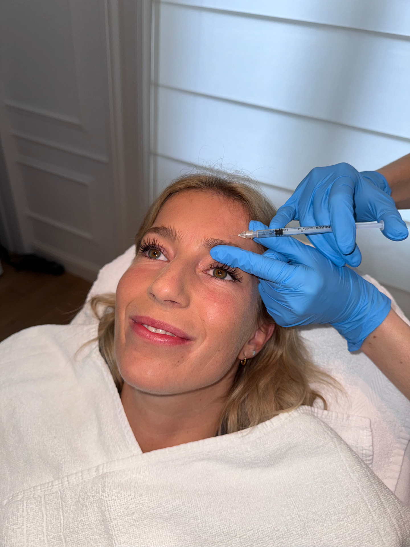Micro en Nanofat Transfer — behandeling bij Clinic 28