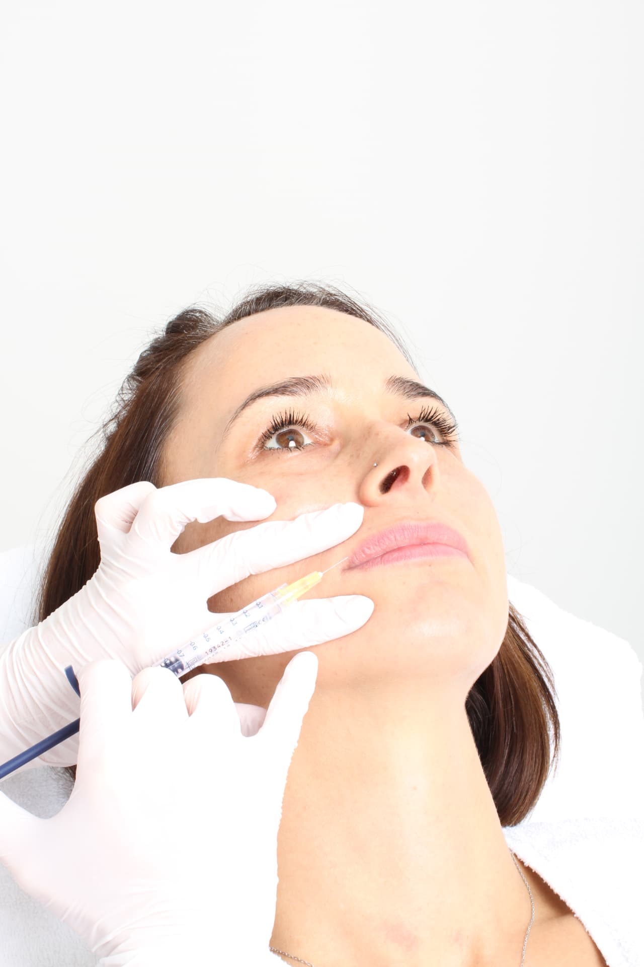 Lipvergroting — behandeling bij Clinic 28
