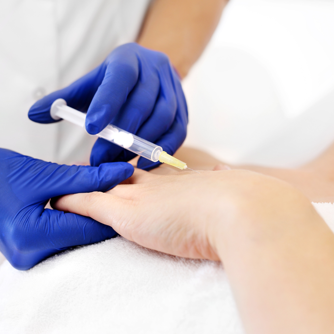Handverjonging — behandeling bij Clinic 28